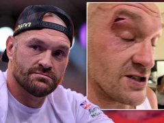 MMA������̩ɭ-���ﲻ�����Ū���˿ڵ�
